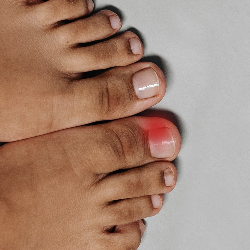 nageltrång
